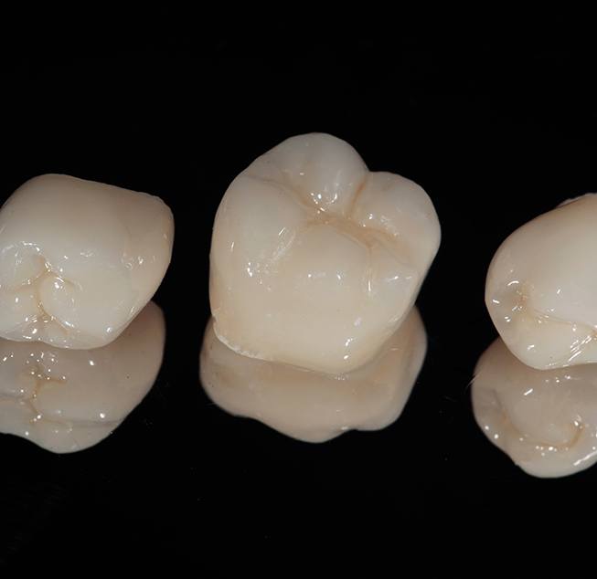 Closeup of a dental crown