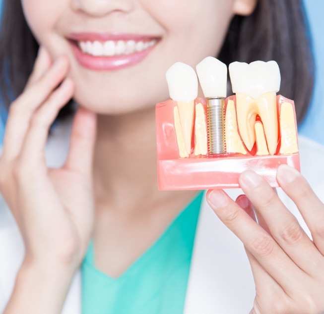 Smiling dentist holding a model of a dental implant