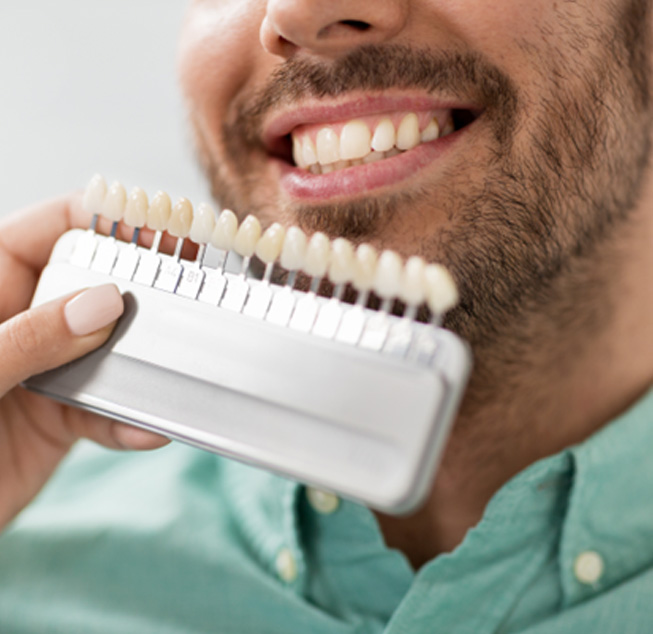 Nose-to-shoulder view of man smiling with shade guide held to his teeth